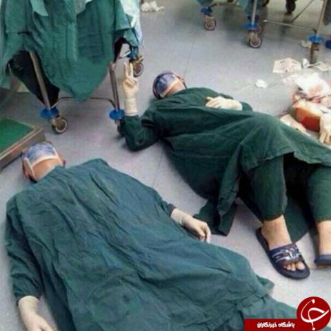 خستگی پس از جراحی ۳۲ ساعته +عکس